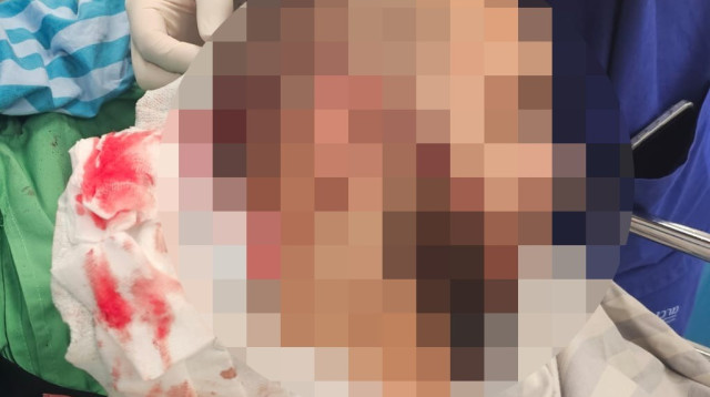 האסיר שהותקף (צילום: דוברות המשטרה)