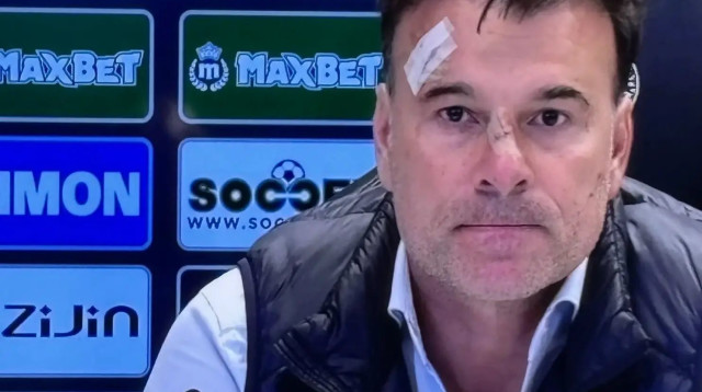 אלכסנדר סטנוייביץ' מאמן פרטיזן בלגרד (צילום: צילום מסך, .)