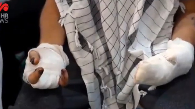 אחד הנפגעים במבצע הביפרים (צילום: רשתות ערביות)