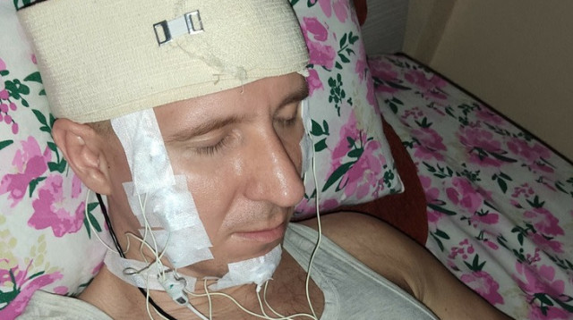 מייקל רדוגה בזמן הניסוי. היה מוכן לסכן את חייו (צילום: REMspace)