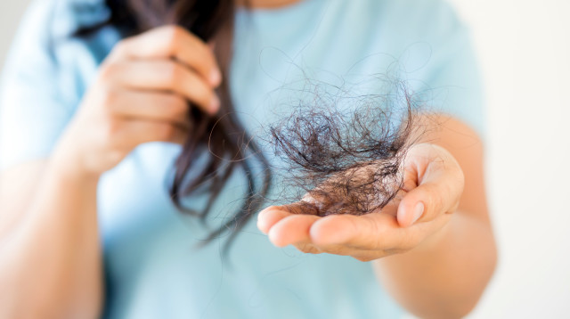 נשירת שיער (צילום: אינגאימג')