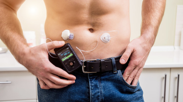 בשורה לחולי הסוכרת: אושר "לבלב מלאכותי" לכל החולים (צילום: אינגאימג')