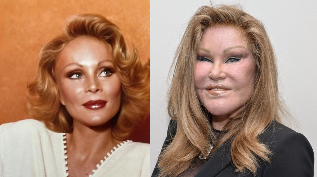 ג'וסלין ווילדנשטיין, אשת החתול, לפני ואחרי (צילום: רשתות חברתיות, Grant Lamos IV \ Getty Images)