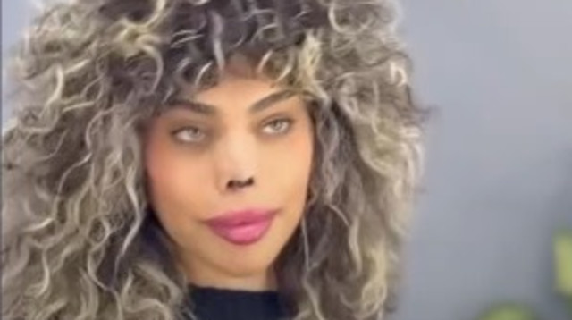 רומי אברג'יל לאחר הזיהום. הרס הסחוס (צילום: אינסטגרם)