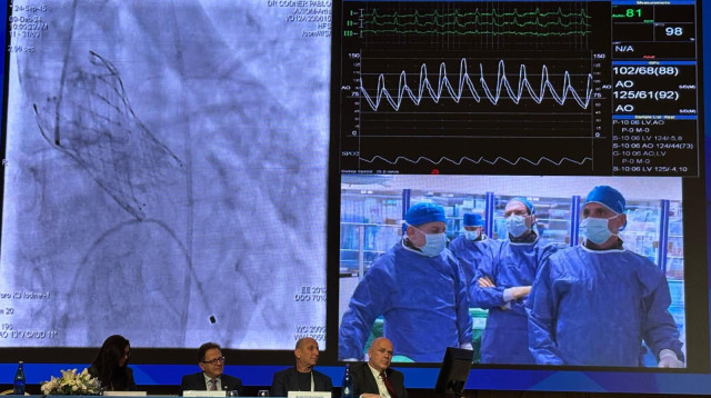 צנתורים חדשניים בשידור חי  (צילום: דוברות בלינסון)