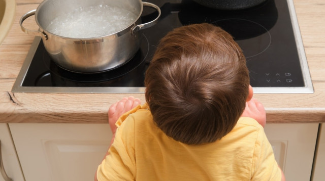 כוויות. הטיפול עלול להיות ממושך (צילום: שאטרסטוק)