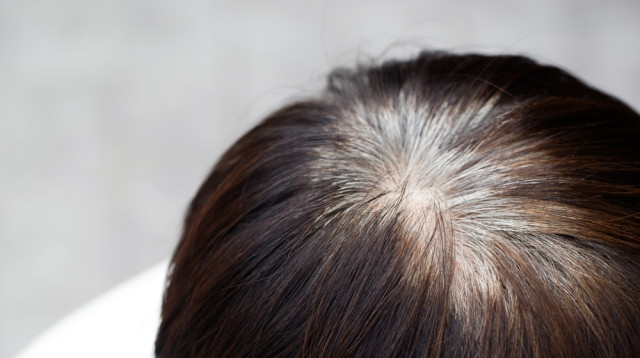 שיער לבן. פגיעה במלנוציטים (צילום: שאטרסטוק)