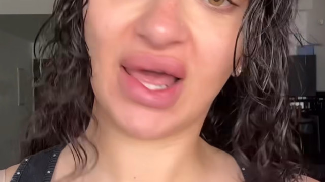 פרידה עוזיאל על הפפילומה  (צילום: יחסי ציבור)