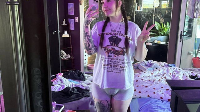 שרה באטון, חושפת את הפגם שהתביישה בו שנים (צילום: אינסטגרם)