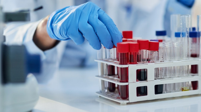 דגימות הדם. התשובות עוד באותו היום (צילום: שאטרסטוק)