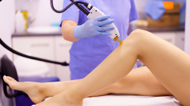 הסרת שיער בלייזר, אילוסטרציה (צילום: אינג'אימג')