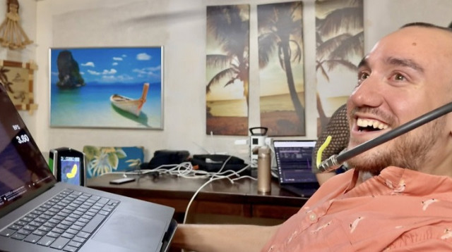 נולנד ארבו. משותק בכל גופו (צילום: נוירלינק)