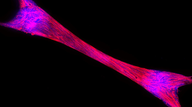 רקמת שריר שגודלה על ידי ProFuse במעבדה (צילום: ProFuse)
