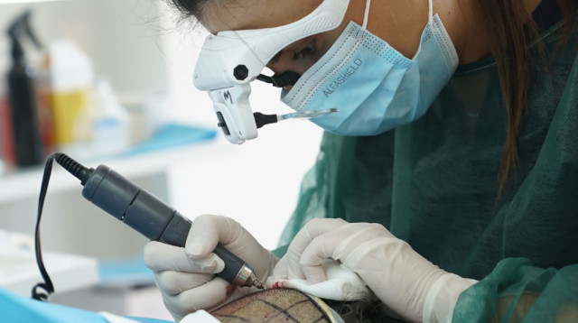 “6 חודשים אחרי: כך שינתה השתלת שיער באתונה את חייו של אופק ברמן” (צילום: יחצ)