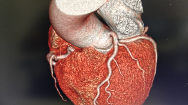 הדמיה תלת מימדית של הלב בעיבוד מתקדם במהלך בדיקת ct (צילום:   מכון מור מגדל המאה)