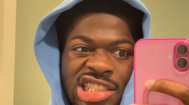 לילי נאס באשפוז. שיתוק בחצי פנים (צילום: אינסטגרם)