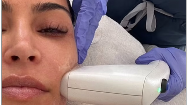 קים קרדישן בטיפול SOFWAVE  (צילום: יח"צ חו"ל)