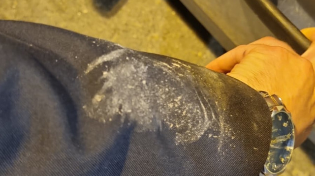 שתי תקיפות אלימות נגד יהודי ברמלה (צילום: פרטי)