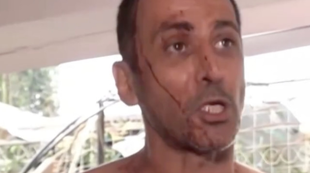 תושב רחובות ניצל מפגיעת טיל בזכות קקי (צילום: צילום מסך רשת 13)