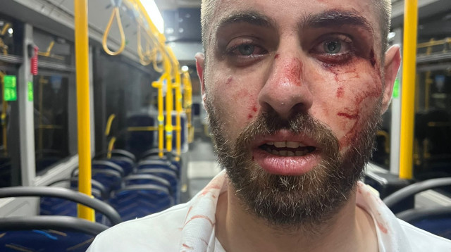 נהג אוטובוס שהותקף בירושלים (צילום: ארגון נהגי האוטובוסים בישראל)