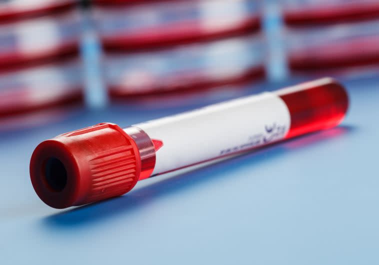 מבחנת דם. הבדיקה לא איתרה את החיידקים רק בשלב מוקדם להתפתחותם. צילום: אינגאימג'