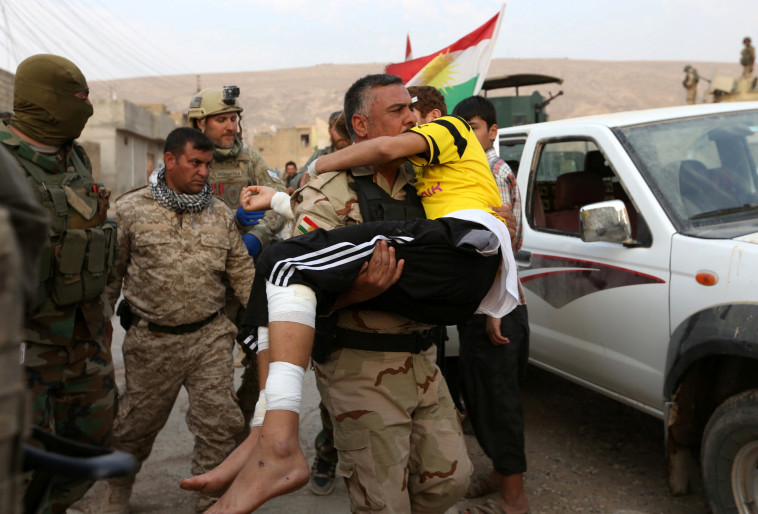 נער פצוע מתקיפה של דאעש מפונה על ידי כוחות הפשמרגה הכורדיים. צילום: רויטרס 