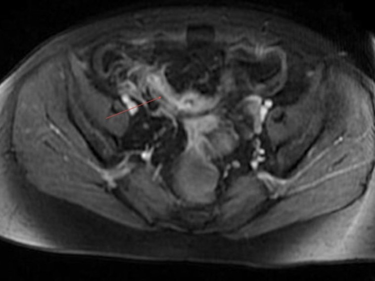  the British Medical Journal :הרופאים הופתעו ממה שמצאו בבטן של האישה. צילום