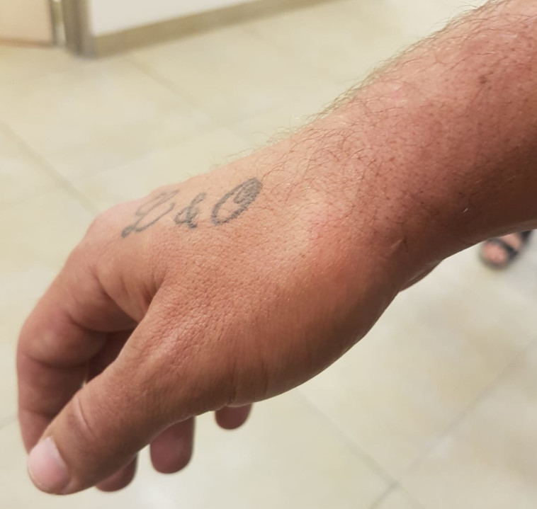 ידו השבורה של לירן סופר. &quot;כתם לכל החיים&quot;