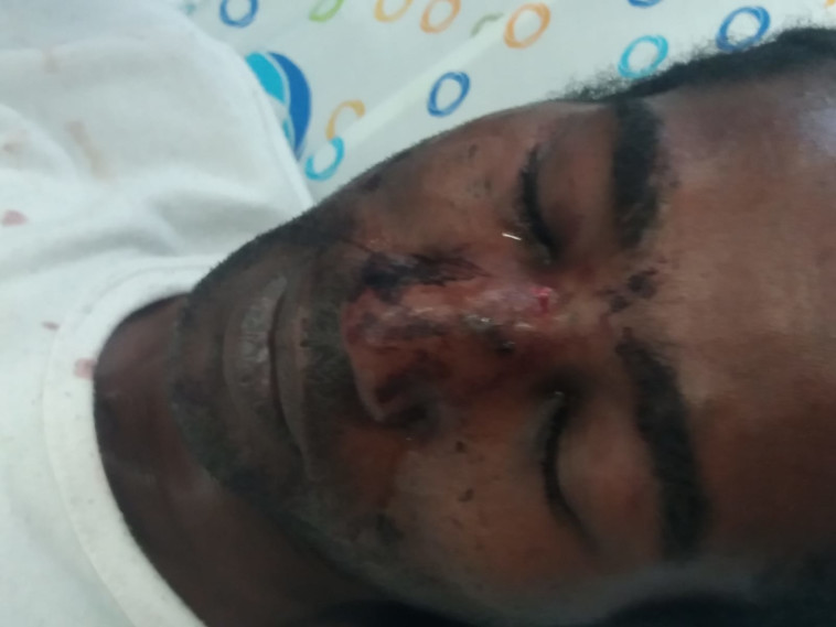 הצעיר בבית החולים