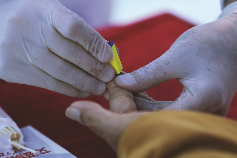 בדיקת איידס. צילום: רויטרס