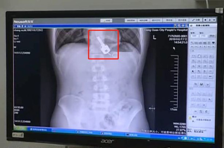 sina.cn :המפתחות לבית והצ'יפ לפתיחת הבניין. צילום מסך