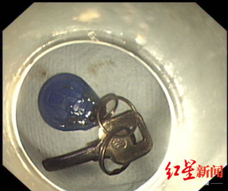 sina.cn :המפתחות לבית והצ'יפ לפתיחת הבניין. צילום מסך