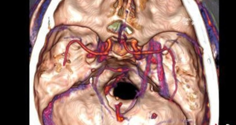 seehua:האזור המתודלק במוחו של ג'או. צילום