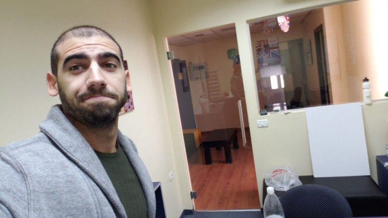 צילום לפני השתלת השיער. צילום: יח