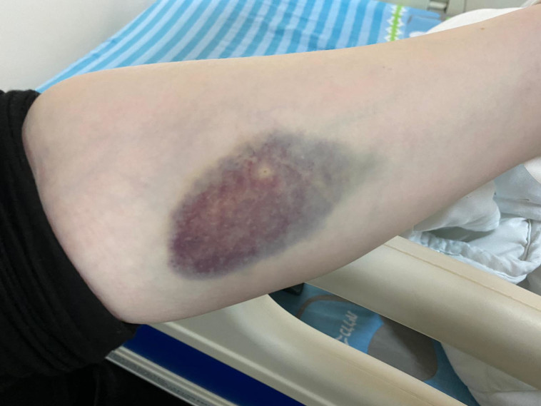 מחלקת הקורונה בבית חולים השרון