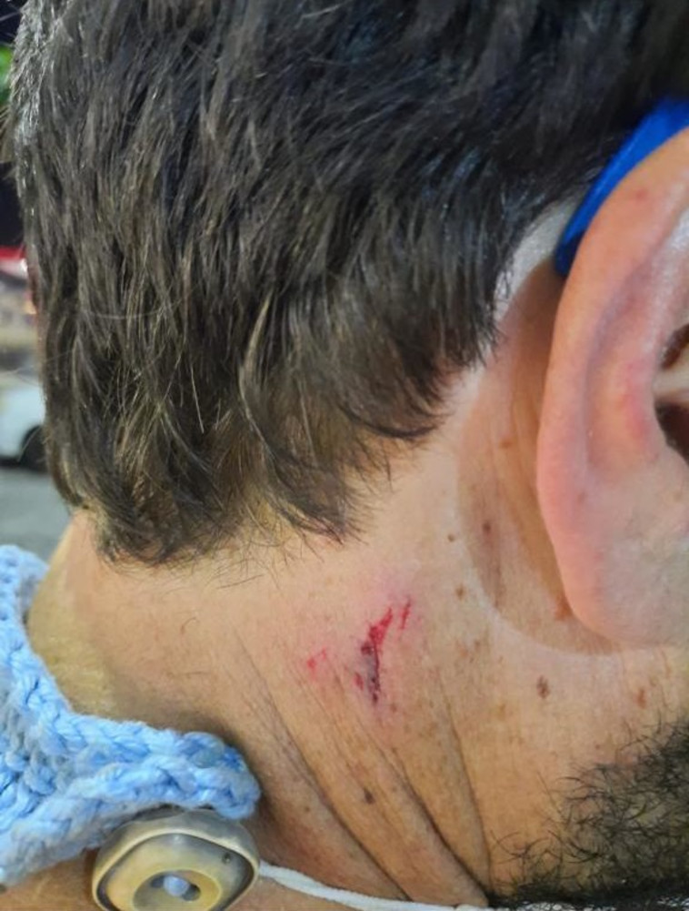 מפגין בשער הנגב נדקר בצווארו 