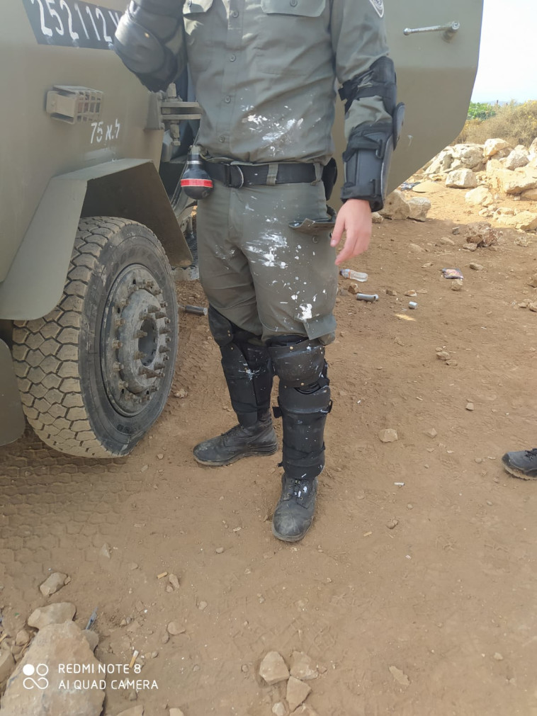 כוח מג''ב שנפגע מבקבוקי הצבע ביצהר