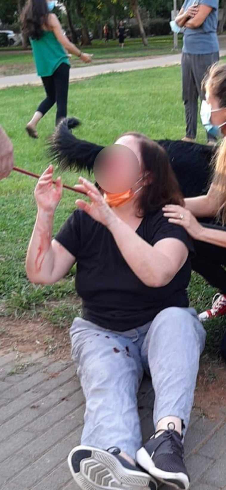 מפגינה שהותקפה ברמת החייל