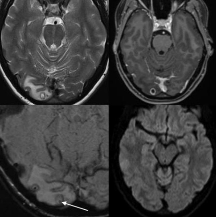 מתוך צילום ה-MRI של האוסטרלית