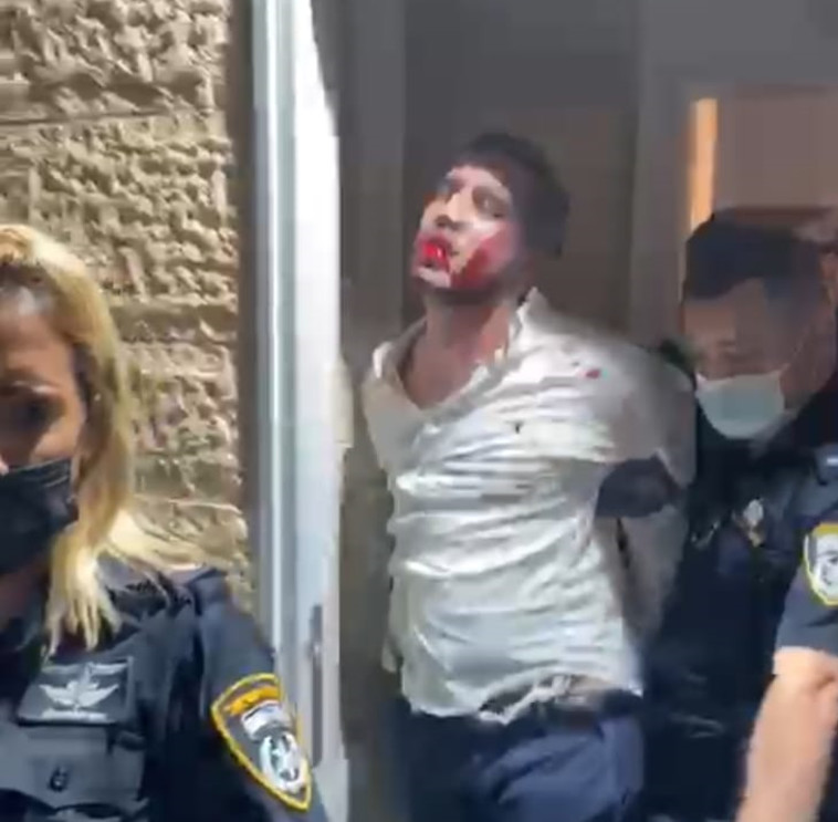 המעצר בחתונה