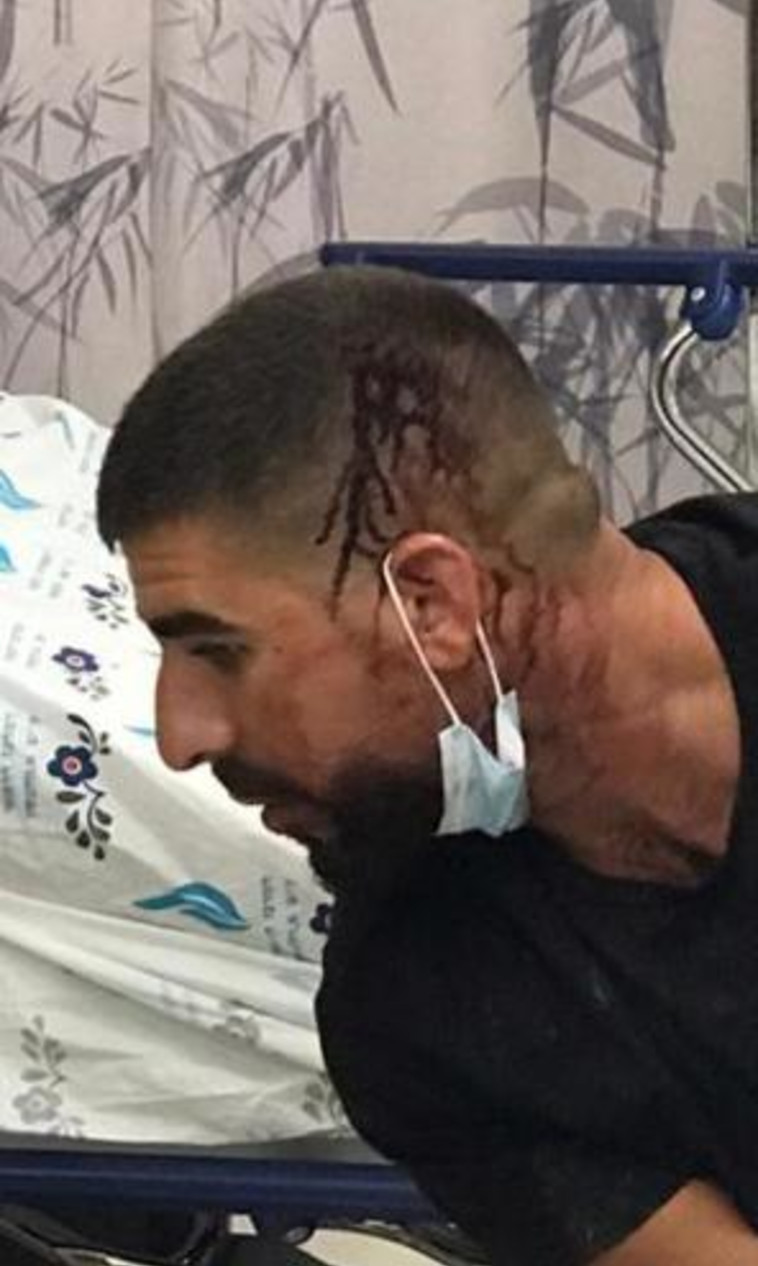 הצעיר שבגינו ניתנה החלטת הנציב