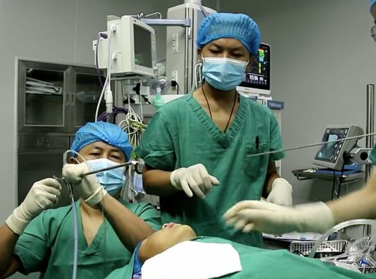 הרופא שלף את העלוקה מגרונו של ילד בסין