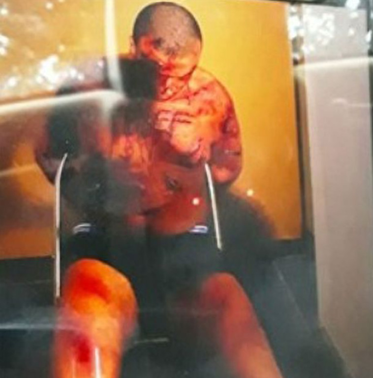 זיוף המוות של סוחר הסמים