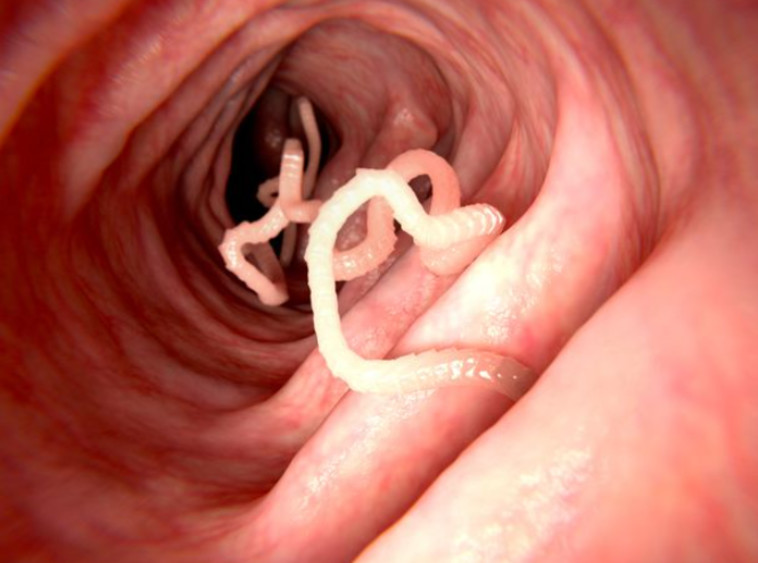 תולעת במעי, אילוסטרציה