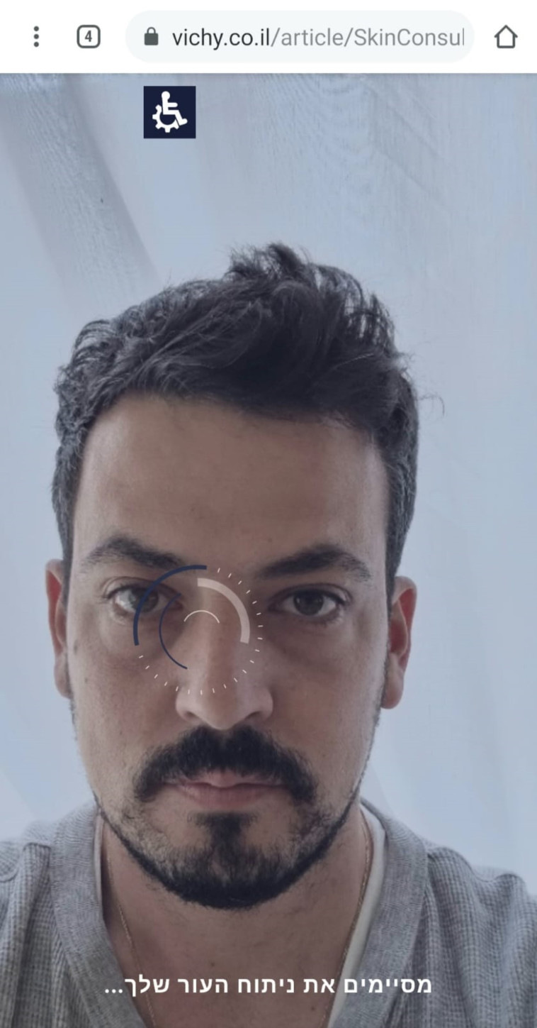 אבחון העור, וישי.