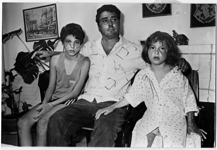 אייבי, ניר ועדי מוזס