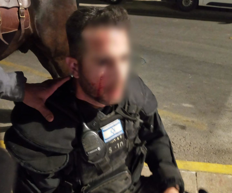 שוטר נפגע מאבן 