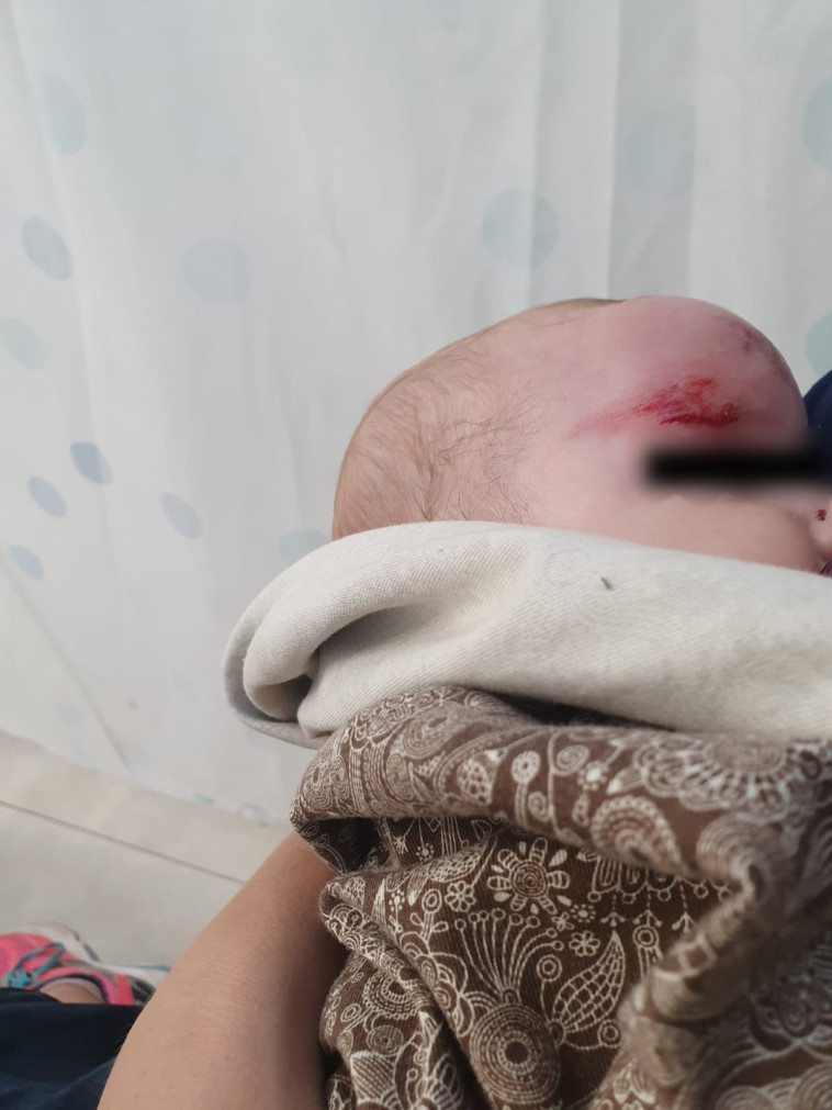 התינוקת שנפצעה מיידוי אבנים בירושלים