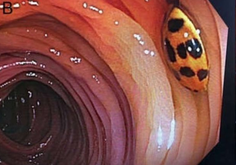 מרת פרת משה