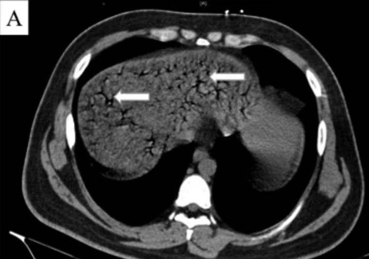 צילום ה-CT של המטופל